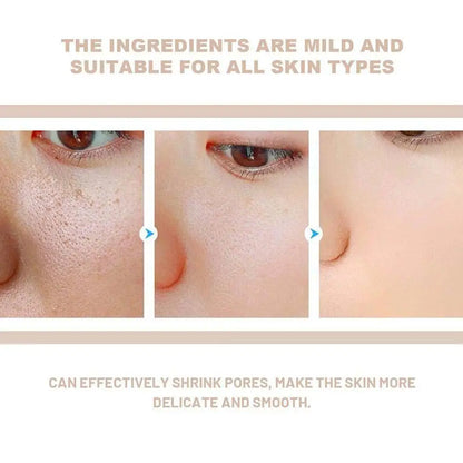 Dr. Melaxin White Black Rice Exfoliating Essence Toner Skin Lightening Contro Deep Moisturizing Shrink Pores Remove Blackheads